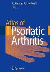 Atlas of Psoriatic Arthritis Edition.