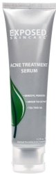 Acne Treatment Day Serum By Exposed Skin Care Benzoyl Peroxide 3.5% Mild Cystic Acne Treatment Serum For Teens And Adults 1.7 Ounces
