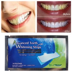 Teeth Whitening Strips Home Dental Bleaching Whiter